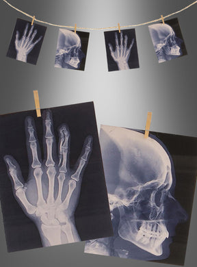 Röntgenbilder einer Hand und eines Schädels sind an einer Schnur befestigt und werden ausgestellt, wodurch eine auffällige „Röntgenbilder-Kette 160 cm ohne Licht“ mit einem graustufigen Hintergrund entsteht – perfekt für Ihre Halloween-Partydekoration oder Skelett-Dekoration.