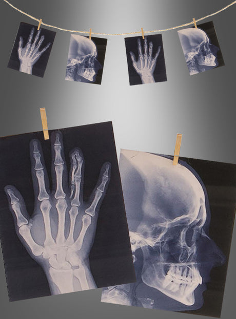 Röntgenbilder einer Hand und eines Schädels sind an einer Schnur befestigt und werden ausgestellt, wodurch eine auffällige „Röntgenbilder-Kette 160 cm ohne Licht“ mit einem graustufigen Hintergrund entsteht – perfekt für Ihre Halloween-Partydekoration oder Skelett-Dekoration.