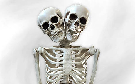 Ein Modellskelett mit zwei am Hals miteinander verbundenen Köpfen, das eine zusammengewachsene anatomische Struktur zeigt, vor einem einfarbigen hellen Hintergrund.